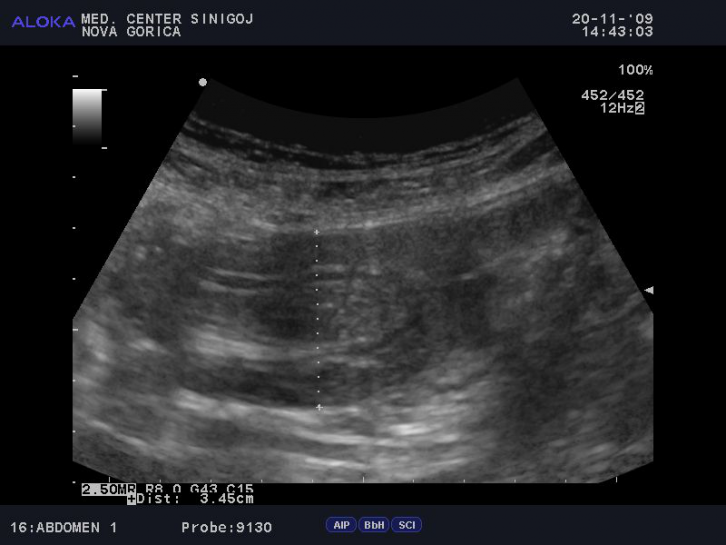 Ultrasound examinations